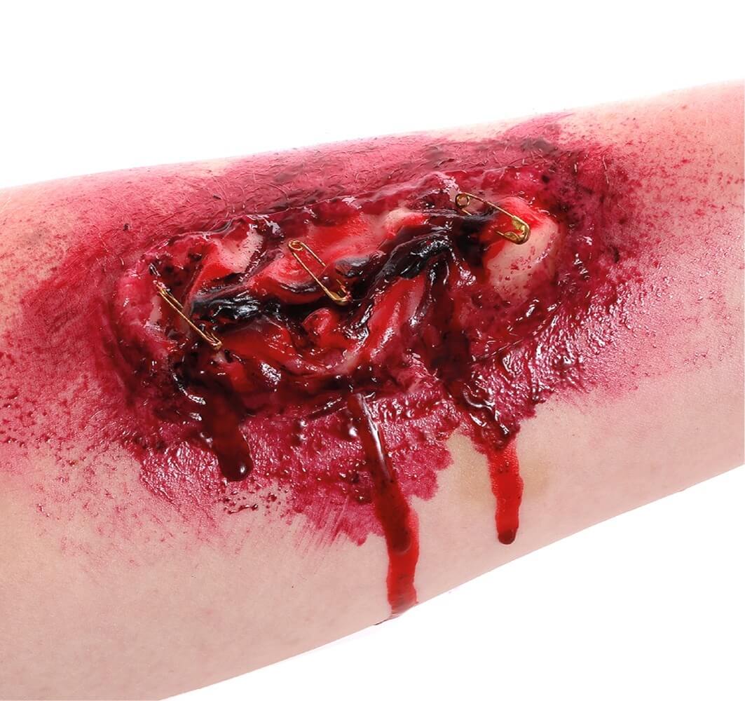 "Un" Safety Pin Scar